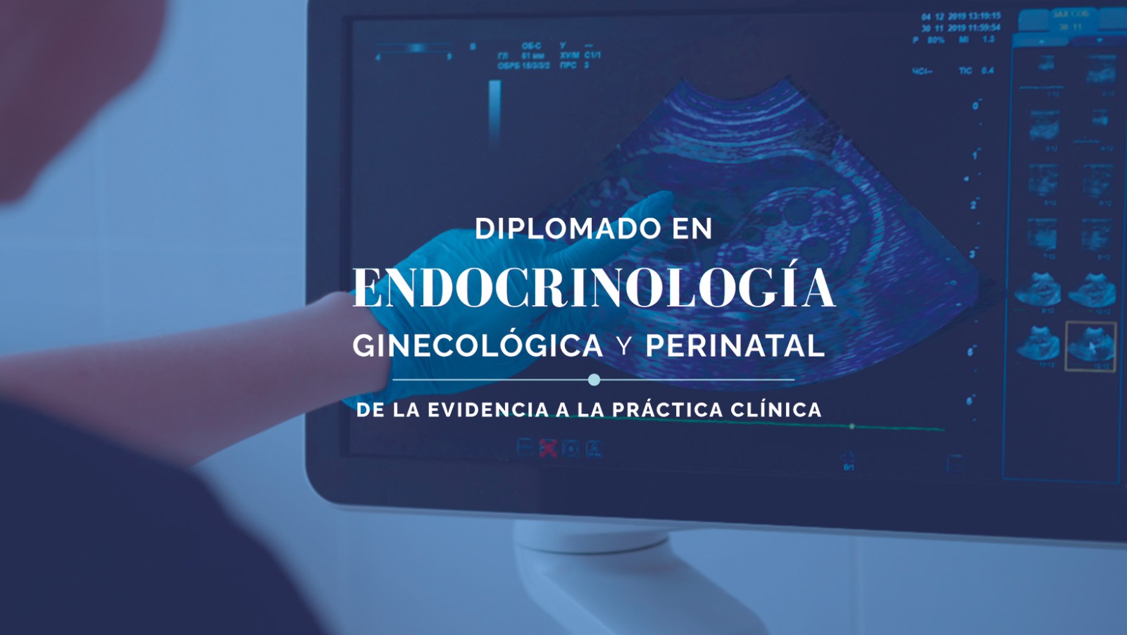 Diplomado en Endocrinología Ginecológica y Perinatal